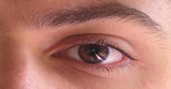 چشم علت و راه درمان پرش پلک چشم