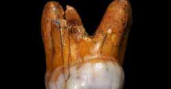 دندان کشف دندان ۱۱۰ هزار ساله انسان